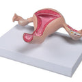 Uterus Model