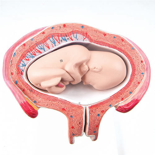 Uterus, 5th Month, Breech