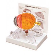 Cornea Eye Budget Model